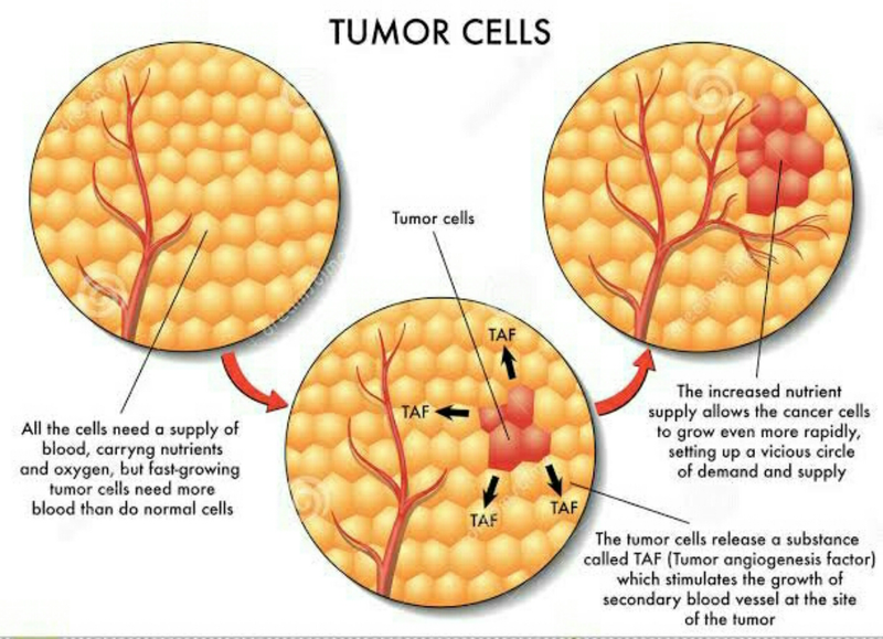 Illustration for article titled Obat Tumor Ganas Yang Sembuhkan Dengan Cepat